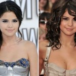 Selena Gomez before and after plastic surgery 03