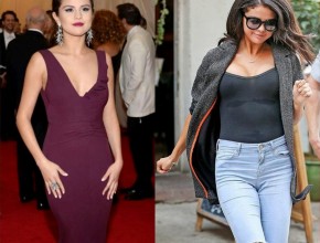 Selena Gomez before and after plastic surgery