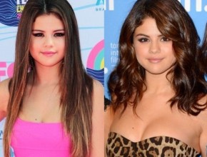 Selena Gomez before and after plastic surgery