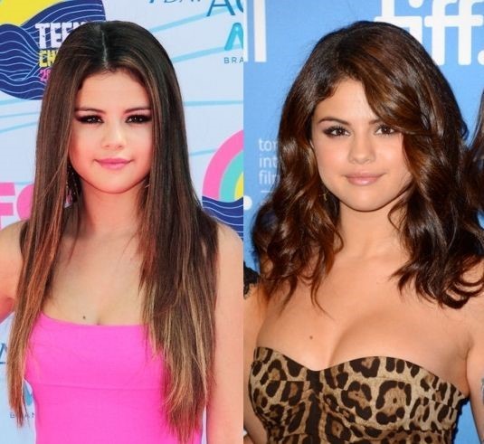 Selena Gomez before and after plastic surgery