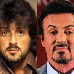 Sylvester Stallone before and after plastic surgery 02