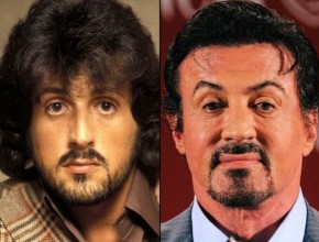 Sylvester Stallone before and after plastic surgery 02