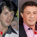 Sylvester Stallone before and after plastic surgery 06
