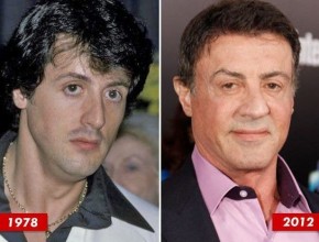 Sylvester Stallone before and after plastic surgery 06