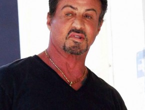 Sylvester Stallone plastic surgery 05