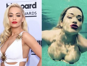 Rita Ora before and after breast augmentation