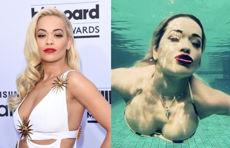 Rita Ora before and after breast augmentation