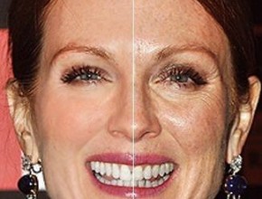 Julianne Moore plastic surgery - Then and now