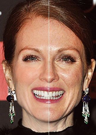 Julianne Moore plastic surgery - Then and now