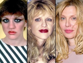 Courtney Love before and after plastic surgery