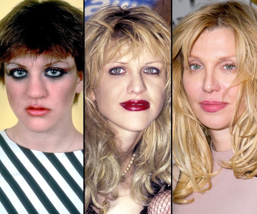 Courtney Love before and after plastic surgery