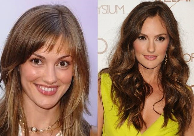 Minka Kelly before and after Plastic surgery