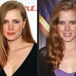 Amy Adams before and after plastic surgery