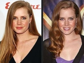 Amy Adams before and after plastic surgery