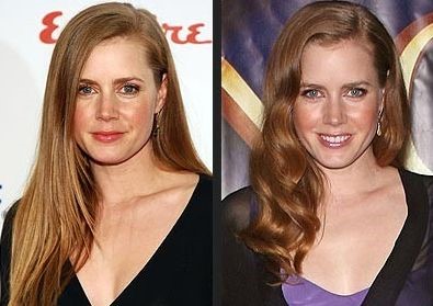 Amy Adams before and after plastic surgery.