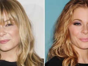 LeAnn Rimes before and after plastic surgery