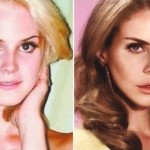 Lana Del Rey before and after plastic surgery