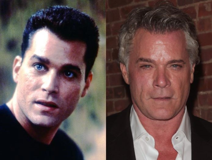 Ray Liotta before and after plastic surgery