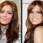 Mandy Moore before and after plastic surgery