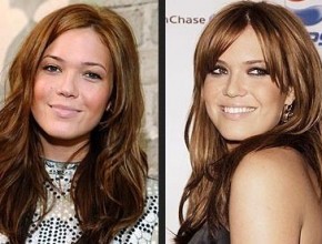 Mandy Moore before and after plastic surgery