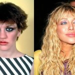 Courtney Love before and after plastic surgery