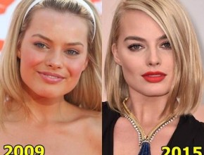 Margot Robbie before and after plastic surgery