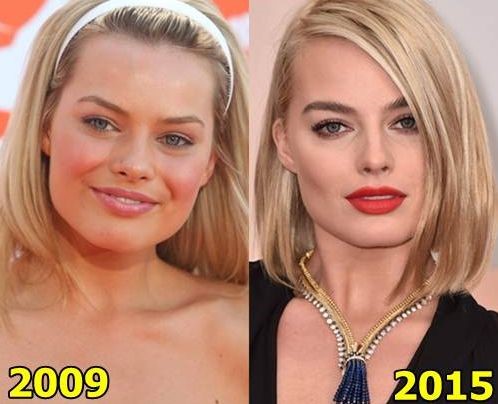 Margot Robbie before and after plastic surgery
