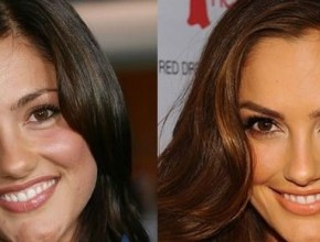 Minka Kelly before and after Plastic surgery