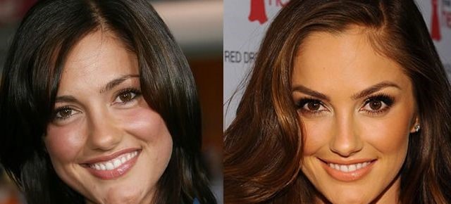 Minka Kelly before and after Plastic surgery