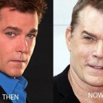 Ray Liotta before and after plastic surgery