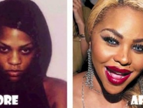 Lil Kim before and after plastic surgery