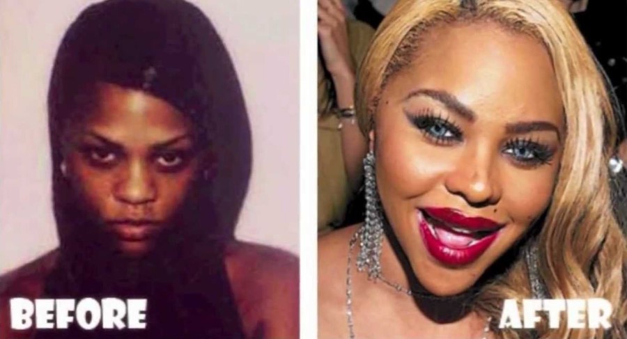 Lil Kim before and after plastic surgery