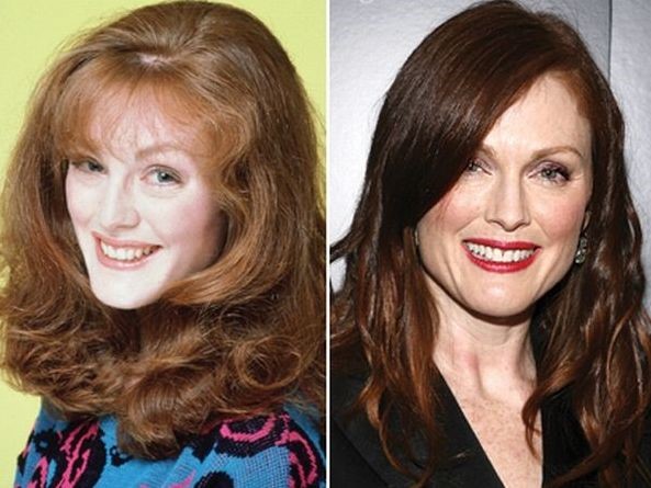 Julianne Moore plastic surgery - Then and now