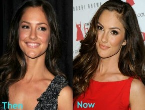Minka Kelly before and after Plastic surgery