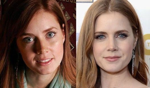 Never the less, it would be fair to say that the alleged nose job Amy Adams under...