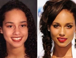 Alicia Keys before and after plastic surgery