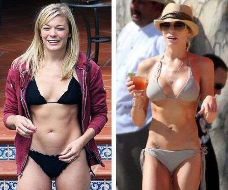 LeAnn Rimes before and after plastic surgery