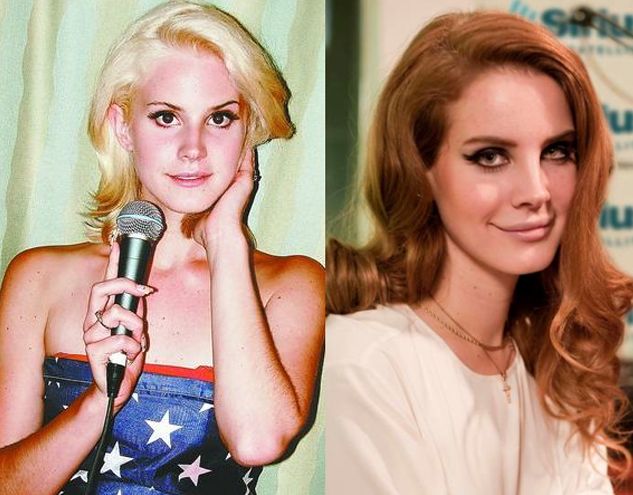 Lana Del Rey before and after plastic surgery
