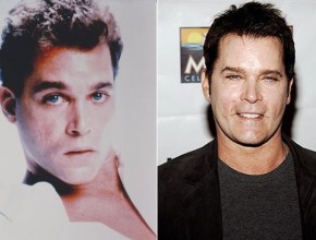 Ray Liotta before and after plastic surgery