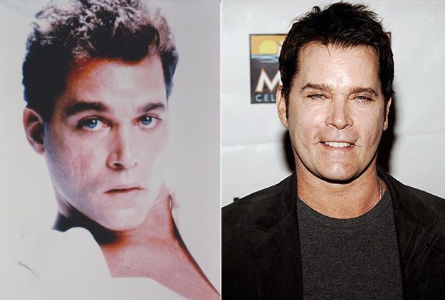 Ray Liotta before and after plastic surgery