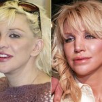 Courtney Love before and after plastic surgery