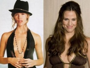 Jennifer Garner before and after plastic surgery