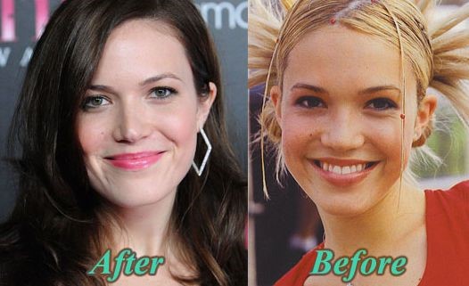 Mandy Moore before and after plastic surgery