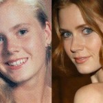 Amy Adams before and after plastic surgery