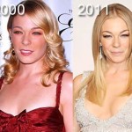 LeAnn Rimes before and after plastic surgery 2