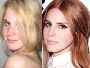 Lana Del Rey before and after nose job
