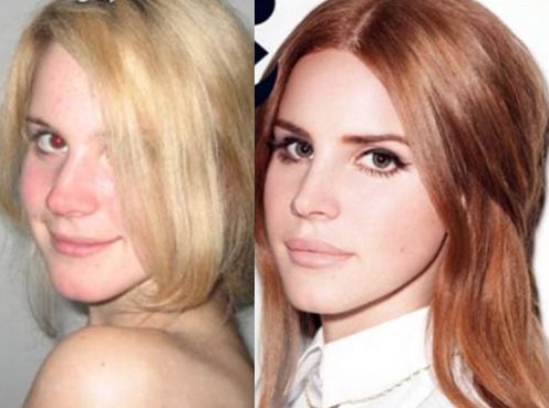 Lana Del Rey before and after nose job