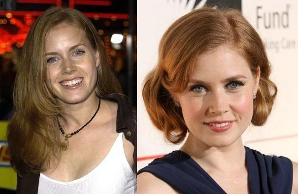 Amy Adams Plastic Surgery for more beautiful face? 