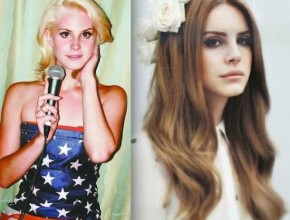 Lana Del Rey before and after plastic surgery