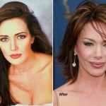 Hunter Tylo before and after plastic surgery 02